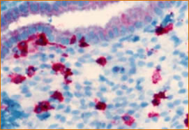 A Short Review of Immunohistochemistry (546)