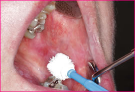 Comparison Between Two Liquid-Based Brush Biopsy Methods (663)