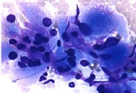 Case Studies in Cytology-19 (795)