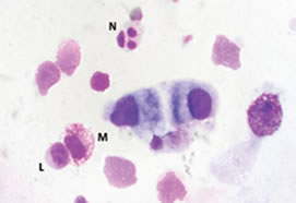 Use of Nasal Cytology in Sinonasal Disorders (798)