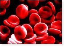 Myelodysplastic Syndrome Review (803)