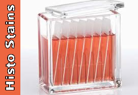 Histological Stains: A Literature Review and Case Study (812)