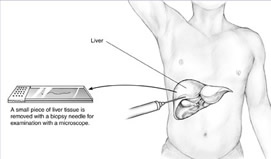 Principles of the Liver Biopsy Procedure (813)