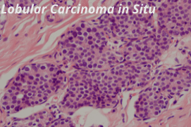 Pathology of Breast Diseases (821)
