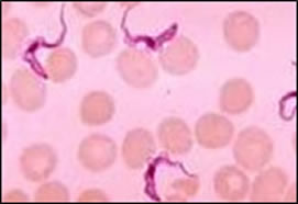 Transfusion Transmitted Infections (826)