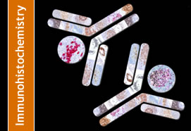 Immunohistochemistry in Cervical Cancer (837)