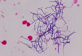 Nocardiosis: Clinical and Pathological Aspects (843)