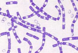 Bioterrorism: A Worldwide Threat (849)