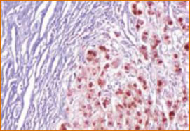 Histopathology of Wilson Disease (890)