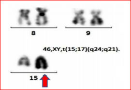 Case Studies in Cytogenetics-21 (916)